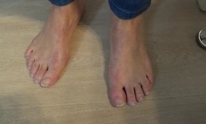 Mature feet